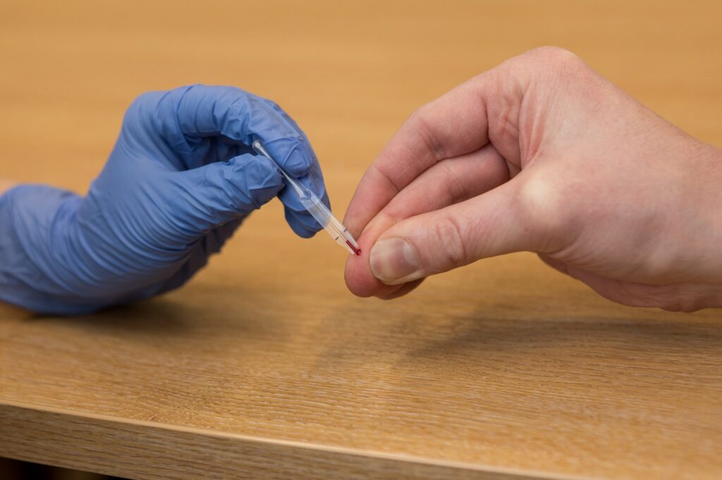 COVID-19 finger prick antibody test